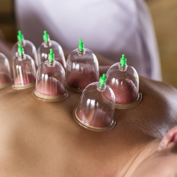 Cupping therapy massage in Limassol, Cyprus